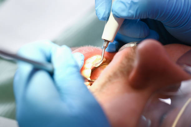 Best Emergency TMJ Treatment in Mebane, NC