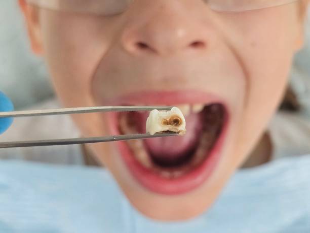 Best Weekend Emergency Dentist in Mebane, NC
